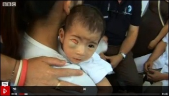 Agent Orange in Vietnam: chemical weapons used by USA have now caused 150,000 childbirth defects according to the Vietnamese Red Cross, photo BBC i-player screen shot