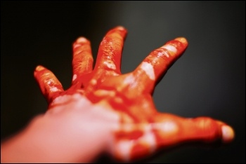 Blood on hand, photo by Giang Gong Du (Creative Commons)