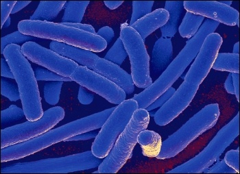 Microscope image of killer E. coli bacteria, photo by NIAID (Creative Commons)