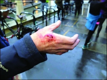 Socialist Party member Mike Luff shows the deep bite wound inflicted by a private security guard Socialist Party member Mike Luff shows the deep bite wound inflicted by a private security guard