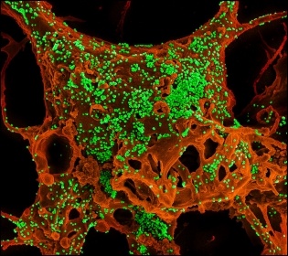 Electron microscope image of an earlier coronavirus variant, photo NIAID/CC