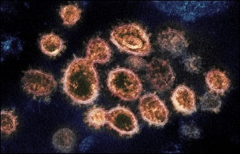 Novel coronavirus Covid-19, photo by NIH/CC