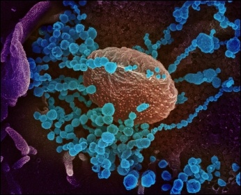 Novel coronavirus Covid-19, photo by NIH/CC